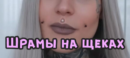Шрамы после пирсинга на щеках